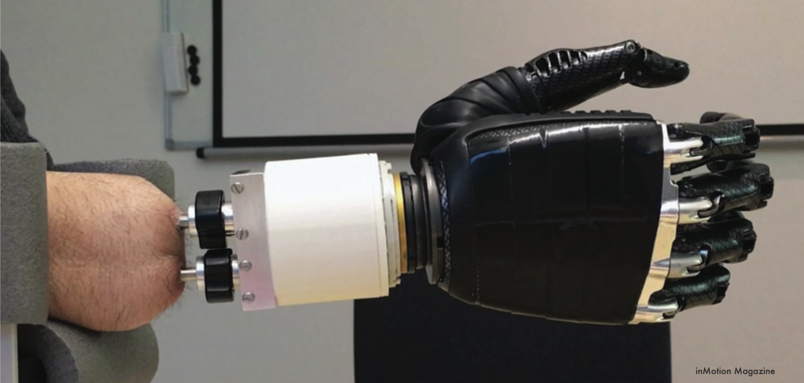 A New Artificial Joint RESTORES WRIST-LIKE MOVEMENTS to Forearm Amputees